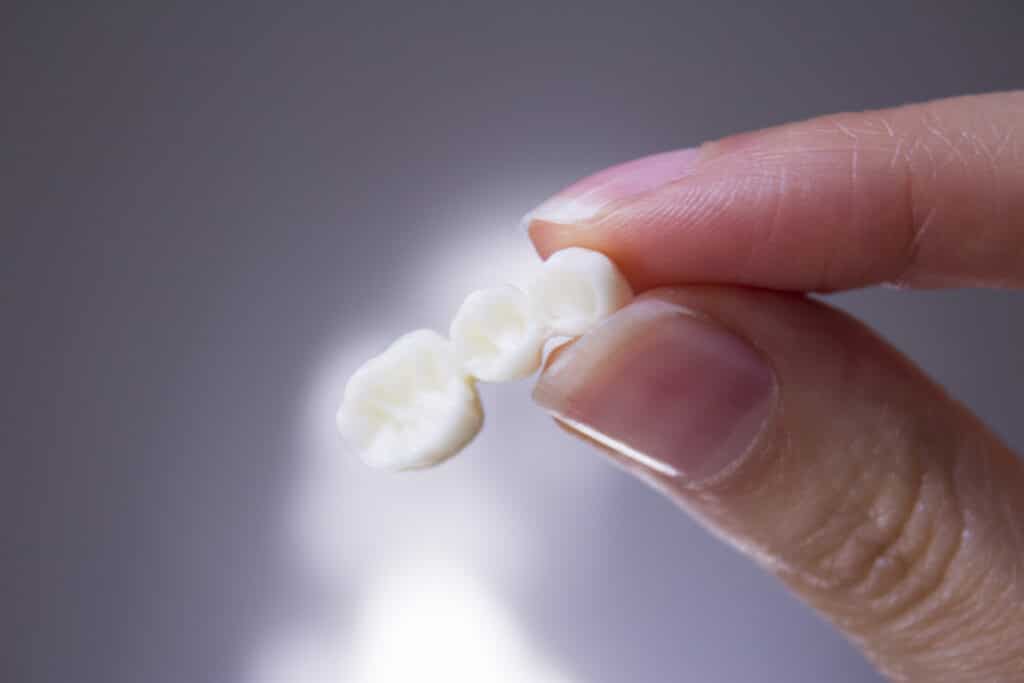 Cerec Same Day Crowns mattapoisett
